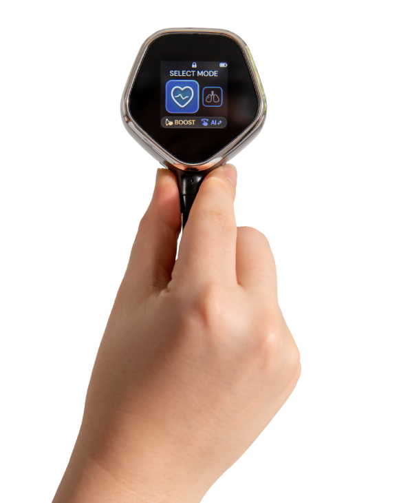VoqX in hand